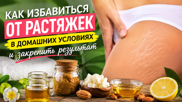 Как избавиться от растяжек в домашних условиях и закрепить результат
