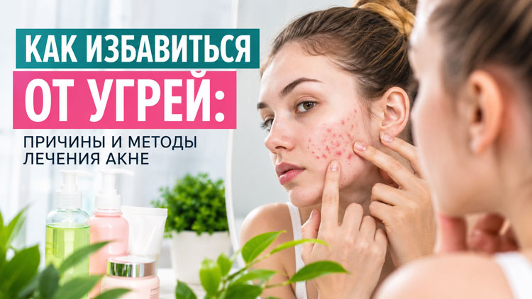 Как избавиться от угрей: причины и методы лечения акне